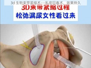 3d 生物束带紧缩术——私密回春术，效果持久