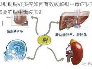 铜铜铜铜铜铜好多疼如何有效缓解铜中毒症状？这里有你需要的铜中毒缓解剂