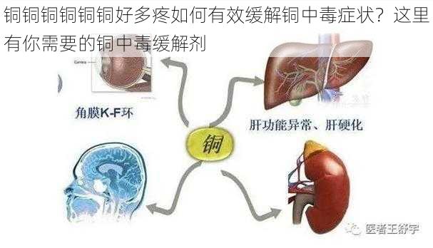 铜铜铜铜铜铜好多疼如何有效缓解铜中毒症状？这里有你需要的铜中毒缓解剂